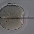 A human oocyte is held by a glass holding pipette (left). A beveled glass pipette containing an immobilized ejaculated spermatozoon is inserted through the zona pellucida and deep into the oolemma, creating a deep furrow. Once the membrane of the oocyte is penetrated, the sperm is deposited therein.