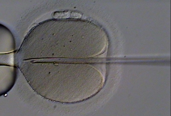 A human oocyte is held by a glass holding pipette (left). A beveled glass pipette containing an immobilized ejaculated spermatozoon is inserted through the zona pellucida and deep into the oolemma, creating a deep furrow. Once the membrane of the oocyte is penetrated, the sperm is deposited therein.
